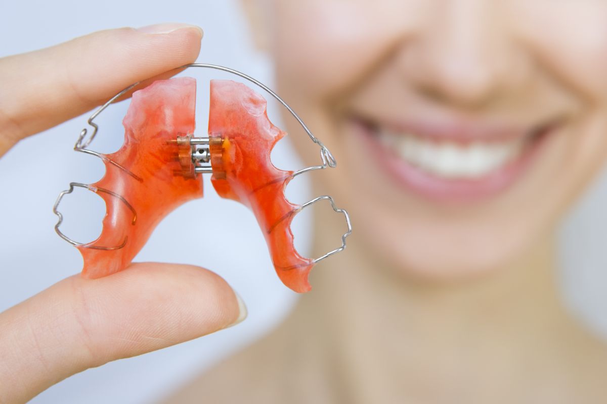 Everything You Need to Know About Orthodontics